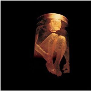 Alice In Chains: Nothing Safe-The Best Of The Box